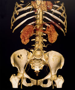Imagen anatómica tomada del nuevo TAC